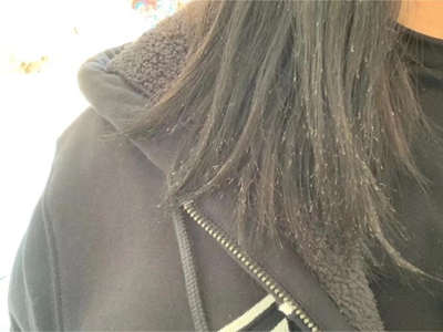頭髮分叉頭髮末端有白點圖 頭髮分叉頭髮末端有白點圖