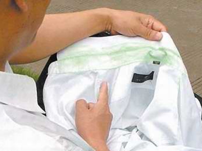 色汗症脖子出汗衣領被染上綠色圖